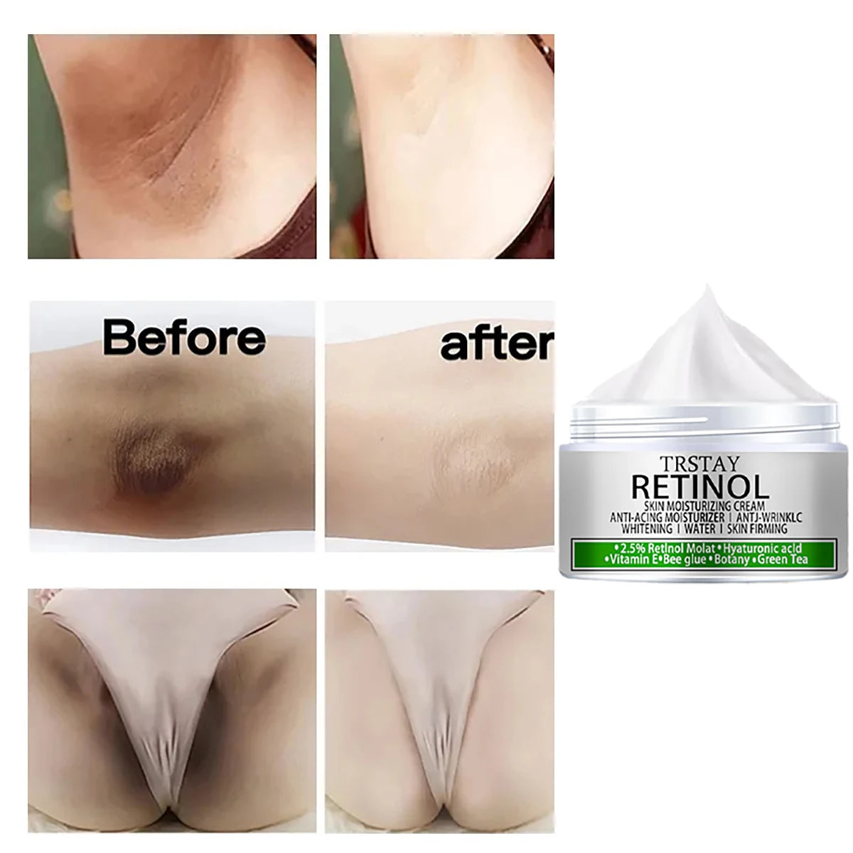 Creme clareador para partes íntimas e corpo.