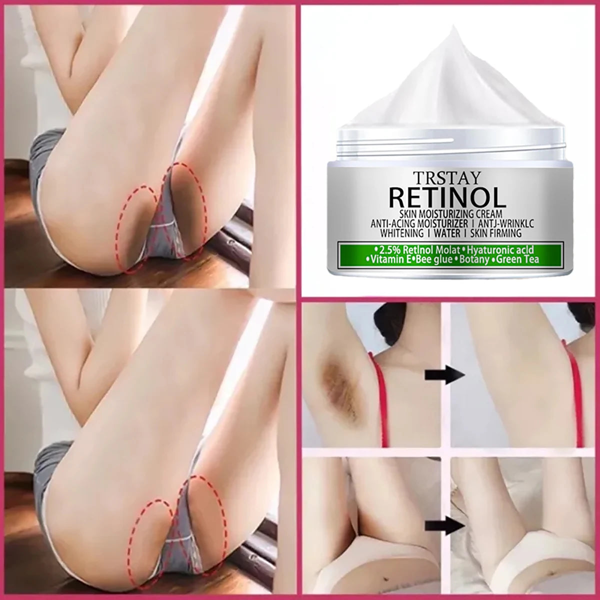 Creme clareador para partes íntimas e corpo.